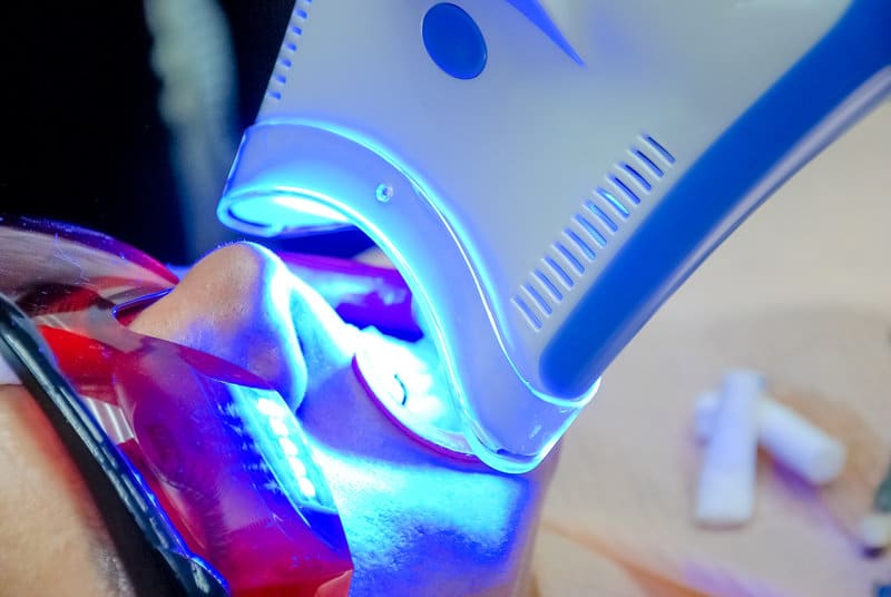 Adult female receiving teeth whitening procedure.portrait of a female